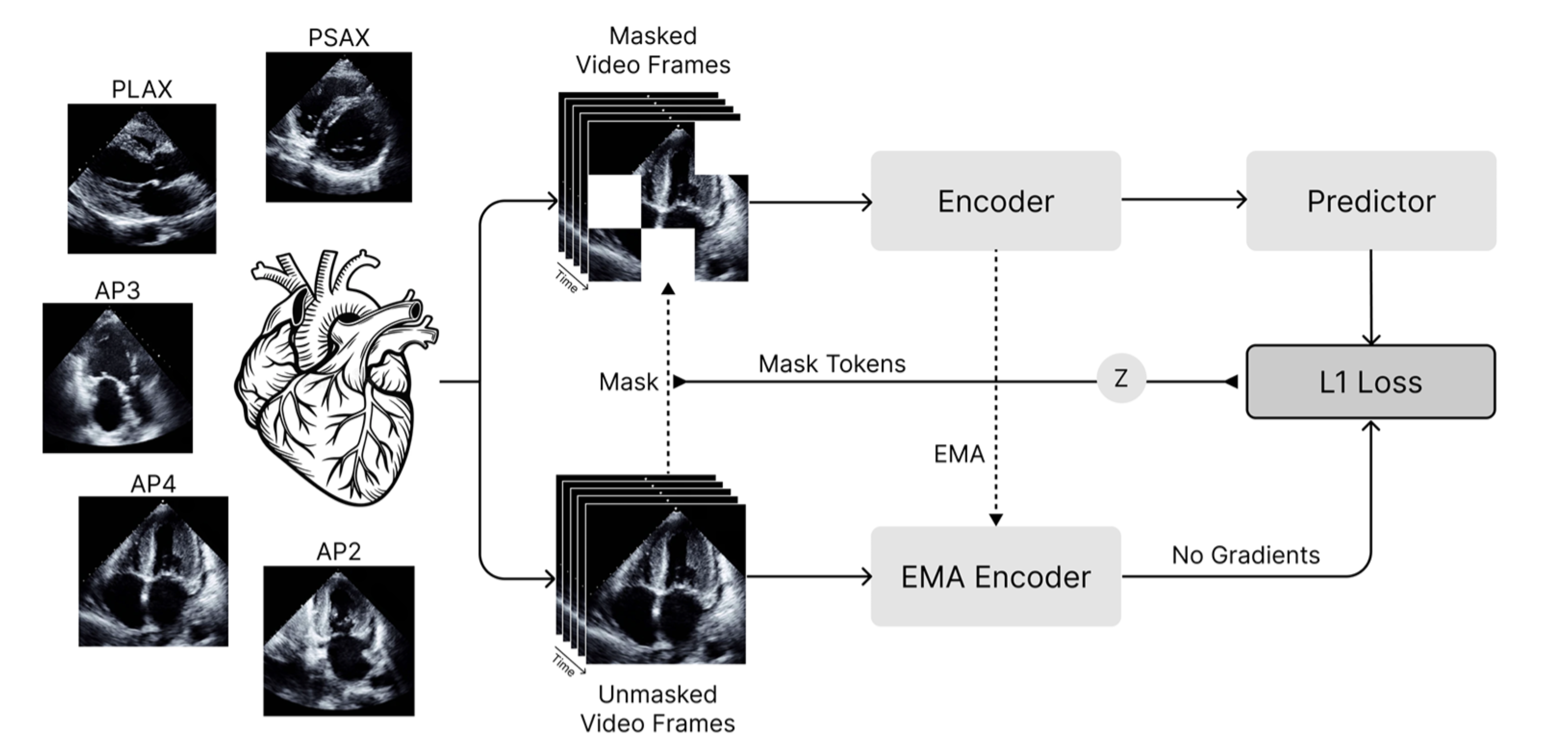 EchoJEPA echocardiography foundation model